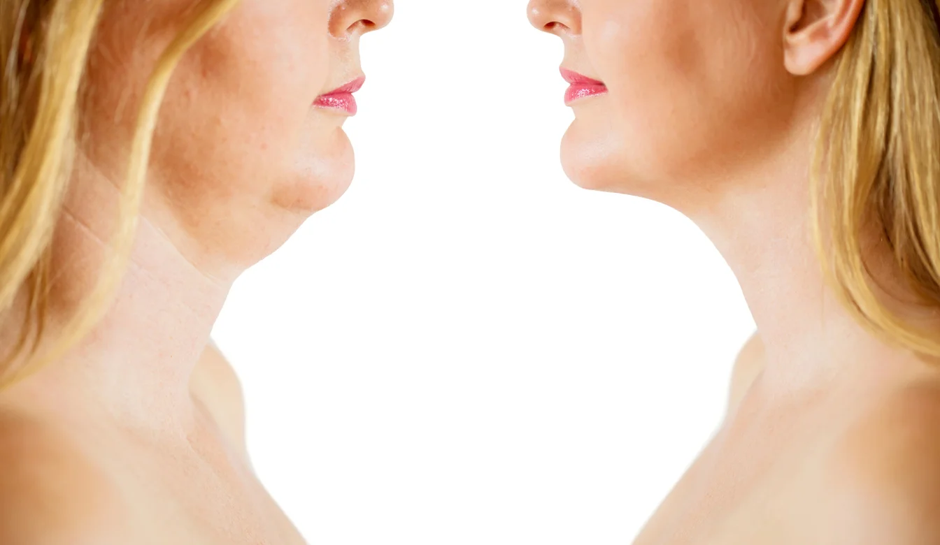 Liquid LIpo