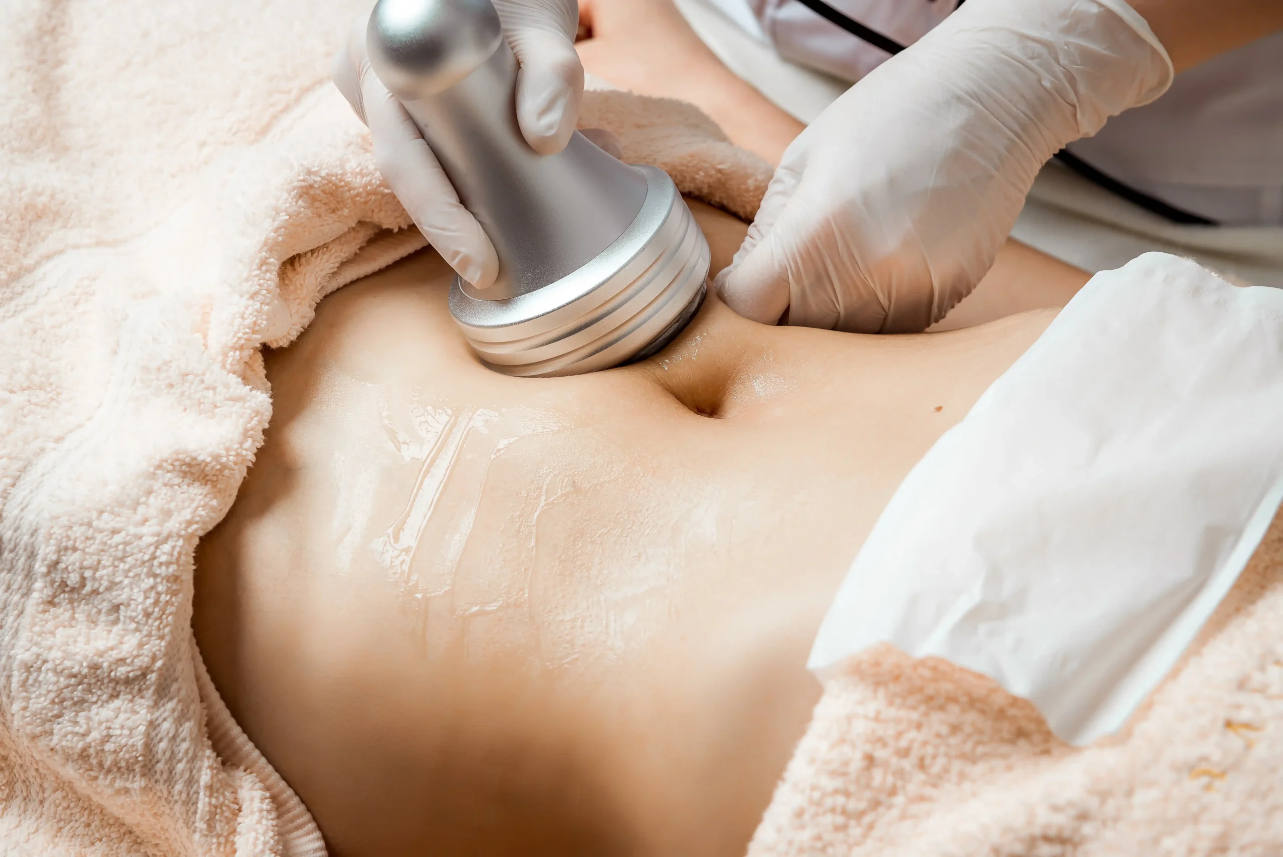 Close-up of a T-Shape 2 device being used on a woman’s abdomen during a non-invasive body sculpting treatment in Lehi, Utah